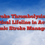 Stroke Thrombolysis: A Critical Lifeline in Acute Ischemic Stroke Management